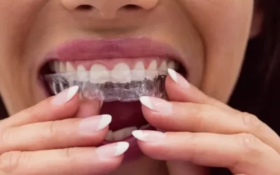 Invisalign Spokane: Clear Aligner Therapy for Discreet Orthodontic Correction